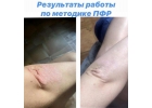 Психо-функциональная разблокировка